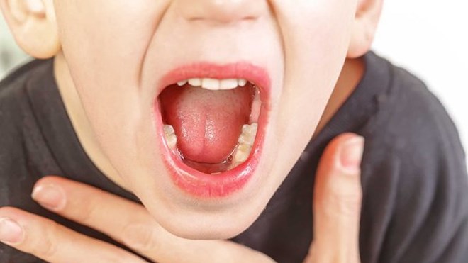 Đừng Coi Thường Viêm Họng Ở Trẻ Nhỏ Đừng Coi Thường Viêm Họng Ở Trẻ Nhỏ - Trường Mầm Non STEAM KIDS